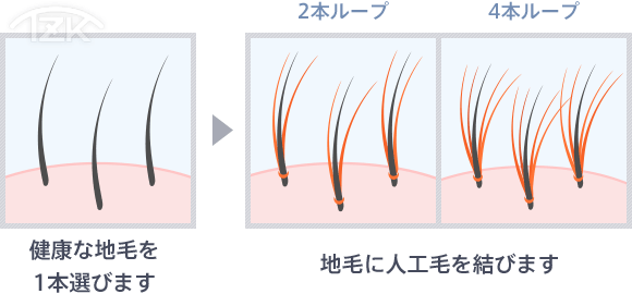 特許増毛協会 増毛技術について | TZK増毛
